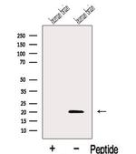 RABL4 Antibody in Western Blot (WB)