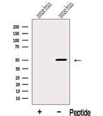 IGSF21 Antibody in Western Blot (WB)