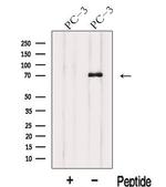 IL17RE Antibody in Western Blot (WB)