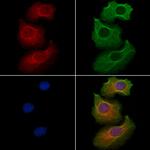 IYD Antibody in Immunocytochemistry (ICC/IF)