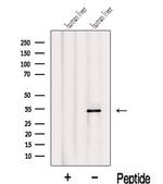 IYD Antibody in Western Blot (WB)