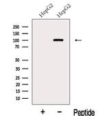 KANK2 Antibody in Western Blot (WB)