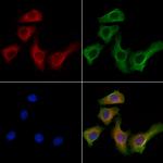 KIF19 Antibody in Immunocytochemistry (ICC/IF)