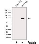 KLC3 Antibody in Western Blot (WB)