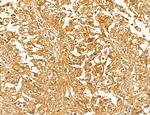 LCA5 Antibody in Immunohistochemistry (Paraffin) (IHC (P))