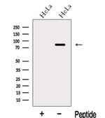 LCA5 Antibody in Western Blot (WB)