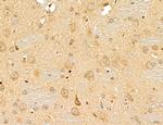 LETM2 Antibody in Immunohistochemistry (Paraffin) (IHC (P))