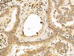 LETM2 Antibody in Immunohistochemistry (Paraffin) (IHC (P))