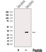 LETM2 Antibody in Western Blot (WB)