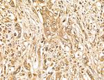 LOH12CR1 Antibody in Immunohistochemistry (Paraffin) (IHC (P))