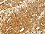 LOH12CR1 Antibody in Immunohistochemistry (Paraffin) (IHC (P))