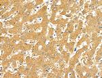 LOH12CR1 Antibody in Immunohistochemistry (Paraffin) (IHC (P))