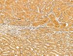 LOH12CR1 Antibody in Immunohistochemistry (Paraffin) (IHC (P))