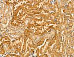 LOH12CR1 Antibody in Immunohistochemistry (Paraffin) (IHC (P))