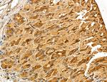 LOH12CR1 Antibody in Immunohistochemistry (Paraffin) (IHC (P))