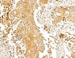 LOH12CR1 Antibody in Immunohistochemistry (Paraffin) (IHC (P))