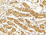 LOH12CR1 Antibody in Immunohistochemistry (Paraffin) (IHC (P))