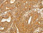 MAN1A2 Antibody in Immunohistochemistry (Paraffin) (IHC (P))