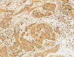 MAN1A2 Antibody in Immunohistochemistry (Paraffin) (IHC (P))