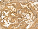 MAN1A2 Antibody in Immunohistochemistry (Paraffin) (IHC (P))