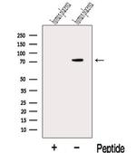 MAN1A2 Antibody in Western Blot (WB)