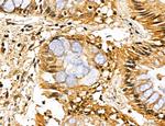 MAP1S Antibody in Immunohistochemistry (Paraffin) (IHC (P))