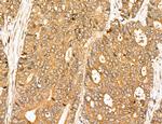 MAP1S Antibody in Immunohistochemistry (Paraffin) (IHC (P))