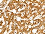 MAP1S Antibody in Immunohistochemistry (Paraffin) (IHC (P))