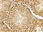 MED10 Antibody in Immunohistochemistry (Paraffin) (IHC (P))