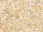 MED10 Antibody in Immunohistochemistry (Paraffin) (IHC (P))