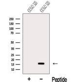 MED10 Antibody in Western Blot (WB)