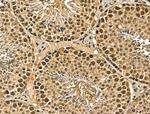 MGAT4C Antibody in Immunohistochemistry (Paraffin) (IHC (P))