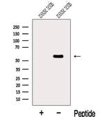 MGAT4C Antibody in Western Blot (WB)