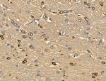 MGAT5B Antibody in Immunohistochemistry (Paraffin) (IHC (P))