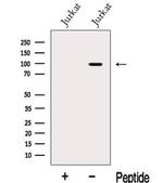 MGAT5B Antibody in Western Blot (WB)