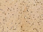 MICAL2 Antibody in Immunohistochemistry (Paraffin) (IHC (P))