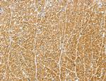 MIPEP Antibody in Immunohistochemistry (Paraffin) (IHC (P))