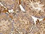 MLK2 Antibody in Immunohistochemistry (Paraffin) (IHC (P))