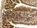 MLK2 Antibody in Immunohistochemistry (Paraffin) (IHC (P))