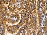 MLK2 Antibody in Immunohistochemistry (Paraffin) (IHC (P))