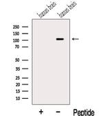 MLK2 Antibody in Western Blot (WB)