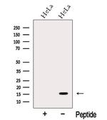 MMS2 Antibody in Western Blot (WB)