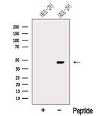 MYLK4 Antibody in Western Blot (WB)