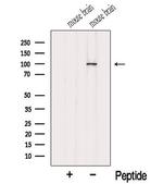 MYO1D Antibody in Western Blot (WB)