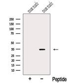 MYOZ1 Antibody in Western Blot (WB)