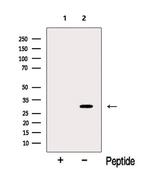 MYOZ2 Antibody in Western Blot (WB)