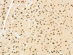 NR1 Antibody in Immunohistochemistry (Paraffin) (IHC (P))