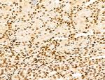 NR1 Antibody in Immunohistochemistry (Paraffin) (IHC (P))