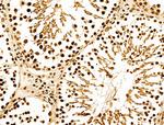 NR1 Antibody in Immunohistochemistry (Paraffin) (IHC (P))