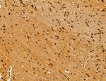 NR1 Antibody in Immunohistochemistry (Paraffin) (IHC (P))